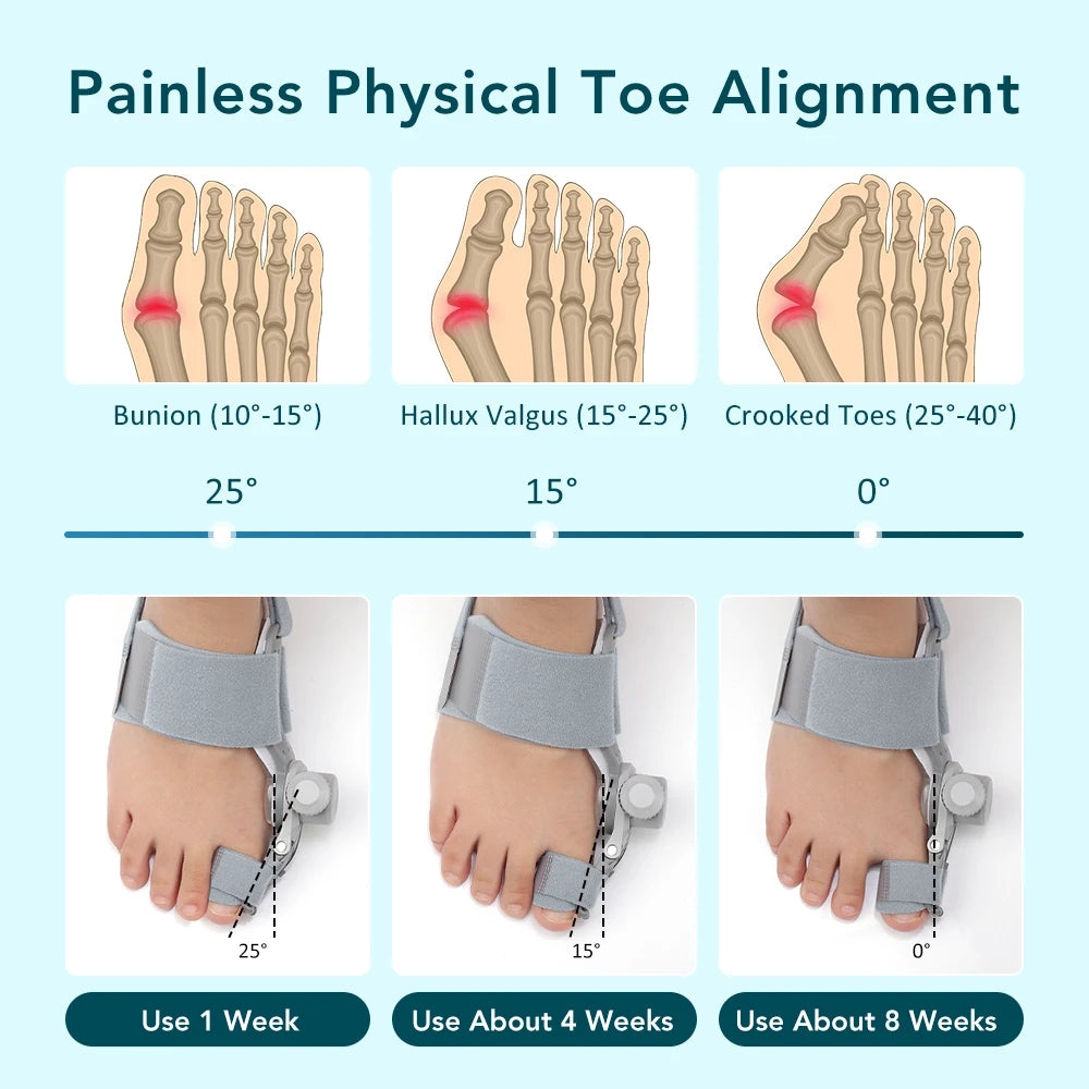 Adjustable Bunion Corrector Toe Splint